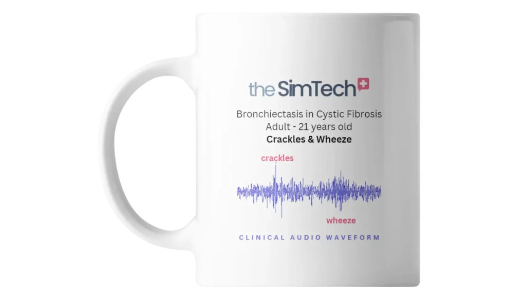 White mug with "the SimTech" logo and text below reading "Bronchiectasis in Cystic Fibrosis Adult - 21 years old Crackles & Wheeze." An audio waveform labeled "crackles" and "wheeze" is also displayed.