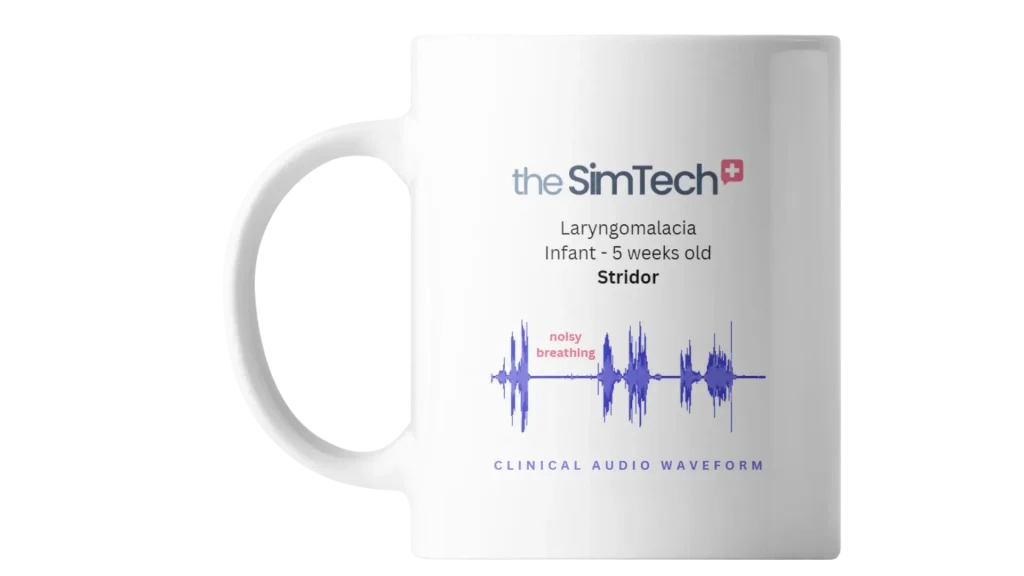 A white mug displays a clinical audio waveform for "Laryngomalacia Infant - 5 weeks old Stridor" with a labeled section indicating "noisy breathing." The text "theSimTech+" is at the top.