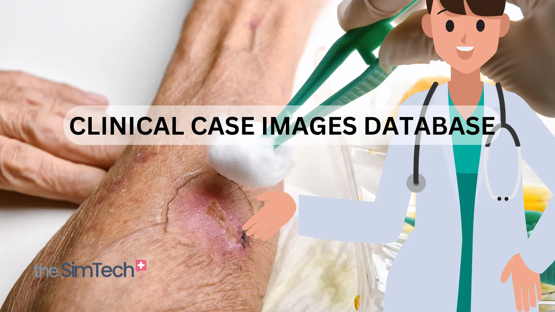 An elderly hand with a visible skin lesion is gently treated by a green-gloved professional using a cotton ball. An illustrated doctor figure appears on the right. Text reads "Clinical Case Images Database," alongside "theSimTech" logo in the bottom left corner.