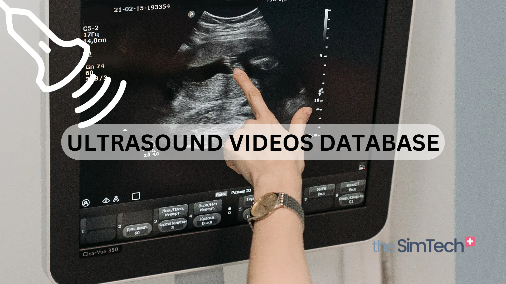 A person gestures towards a monitor showcasing an ultrasound image. The screen flashes "ULTRASOUND VIDEOS DATABASE," while the hand, adorned with a watch, adds a touch of elegance. A sleek logo resides in the bottom right corner, subtly branding the display.